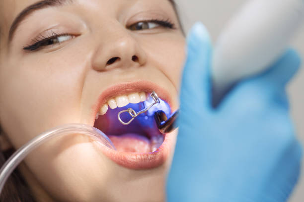 Dental bonding consultation in Yorkville, Toronto