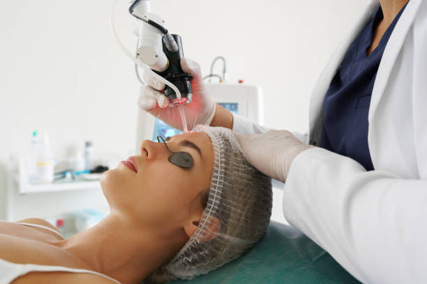 Laser therapy consultation in Yorkville, Toronto
